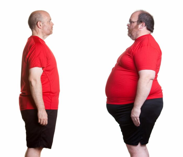obesity - Medical Weight Loss Clinic in Torrance CA